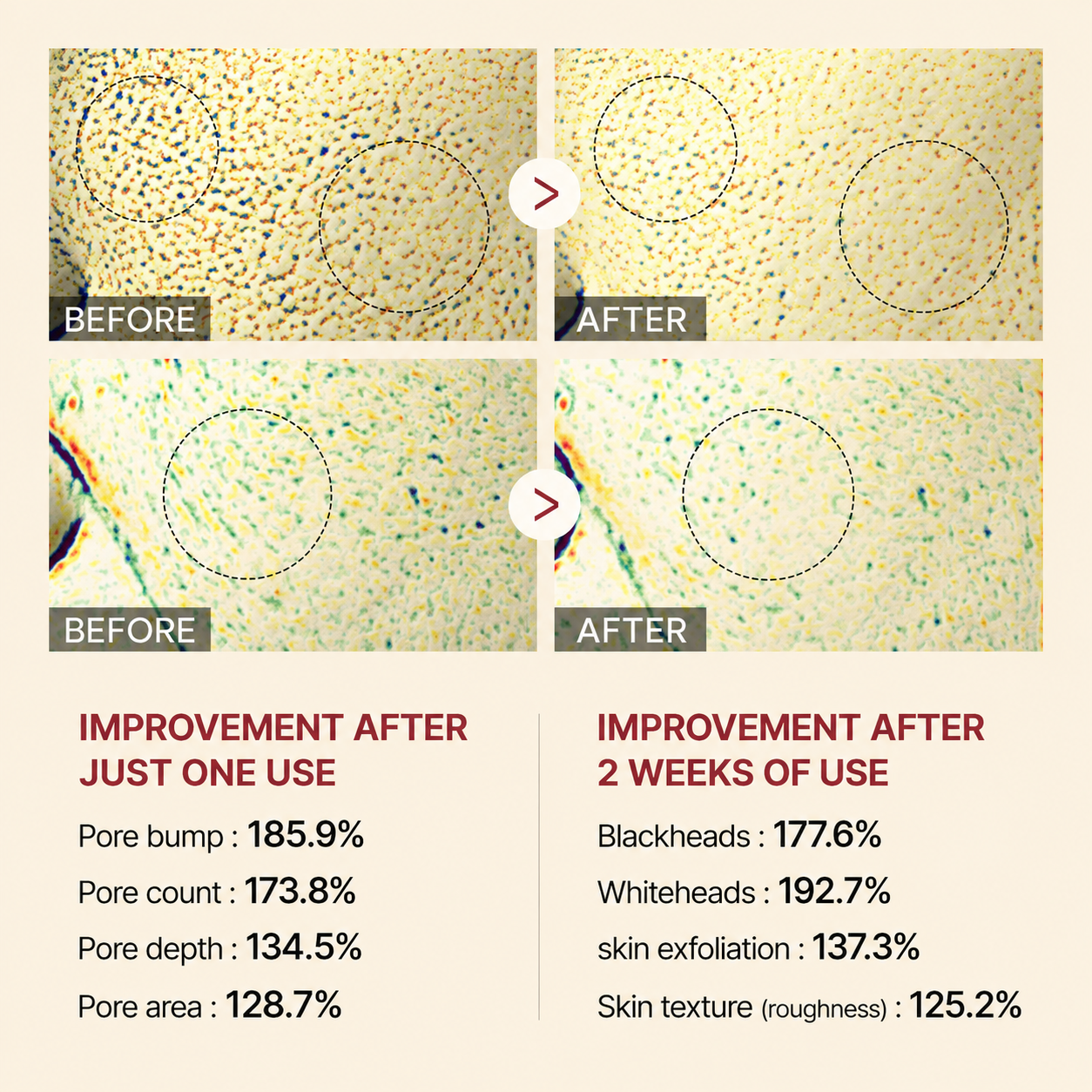 Ccelino®White &amp; Black Rice Renewal Duo